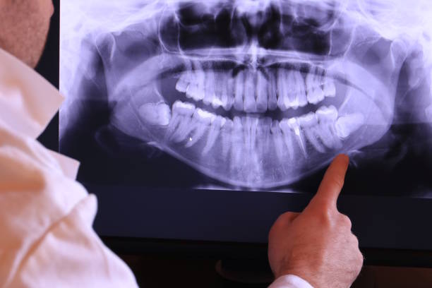 Tooth Infection Emergency Dentist in GA