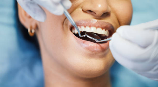 Best Knocked-Out Tooth Emergency  in Thunderbolt, GA